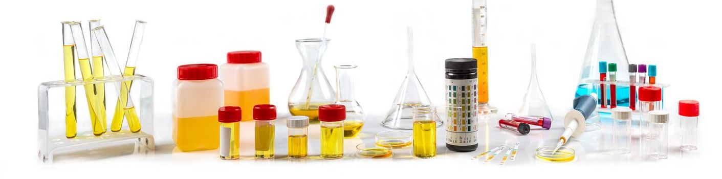panoramic on different urine tests