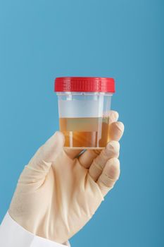 A container for biomaterial with a urine analysis in the hand of a doctor in a white rubber glove on a blue background. The concept of a health check. Free space.