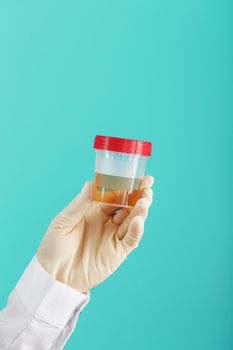 A container for biomaterial with a urine analysis in the hand of a doctor in a white rubber glove on a blue background. The concept of a health check. Free space.