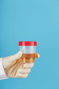 A container for biomaterial with a urine analysis in the hand of a doctor in a white rubber glove on a blue background. The concept of a health check. Free space.