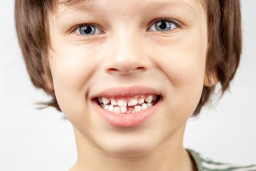 White boy without one bottom front tooth. Dental health concept