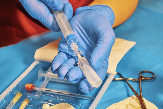 Injection of anesthetic into a syringe