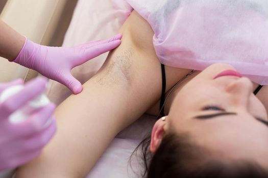 Close-up of armpit of a young girl with hair, hair removal procedure in a beauty salon. Beautician makes shugaring underarms for a young woman. Depilation of armpit with sugar paste