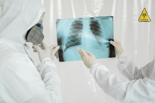 Doctors Epidemiologists examine x-ray for pneumonia of a Covid-19 patient. Coronavirus concept