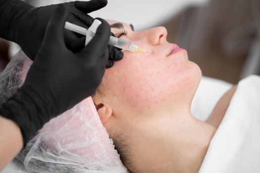 Close-up of cosmetologist makes the Rejuvenating facial injections procedure for tightening on the face skin of woman in a beauty clinic. Biorevitalization procedure.