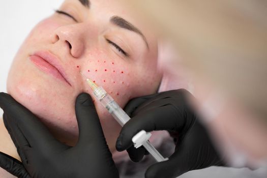 Close-up of cosmetologist makes the Rejuvenating facial injections procedure for tightening on the face skin of woman in a beauty clinic. Biorevitalization procedure.