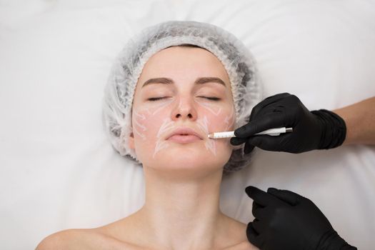 Beautician draws the contours of a white pencil on the face of the patient. Schematic marking before contouring. Close-up preparation of the face for cosmetic plastic surgery