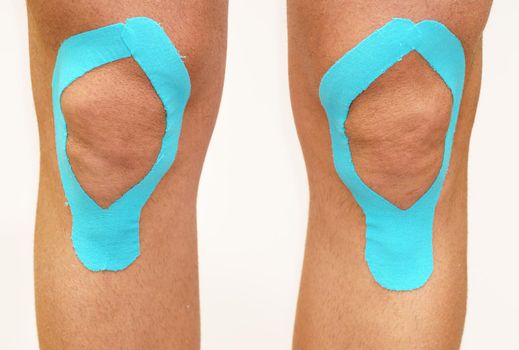 Cucasian Man knees with Lymphatic knee technique. Kinesiology Tape, white background.