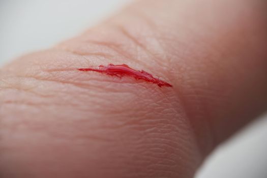 Close-up of man with injured finger, bleeding blood on open cut wound. Macro of cut made with sharp knife. Pain, ache, hurting, help needed, wound concept