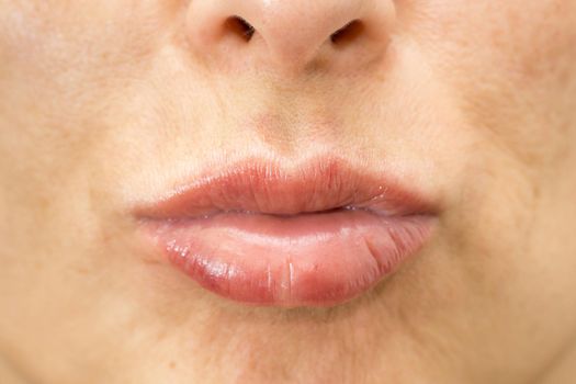 Detailed view of woman swelling lips after beauty treatment, front view