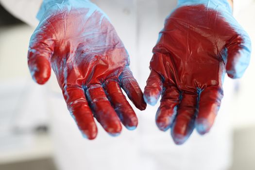 Doctor hands in rubber gloves with blood closeup. Medical care for bleeding concept