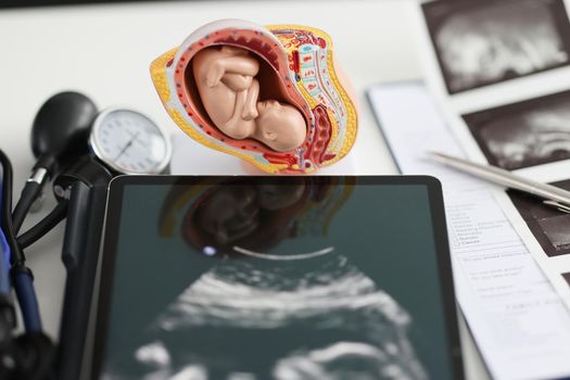 Model of an embryo in the uterus and a tablet with ultrasound on the doctor's table, close-up. Workplace of an obstetrician