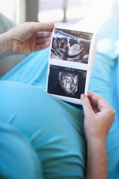 Shot of an unidentifiable pregnant woman holding a sonogram picture while relaxing at home.