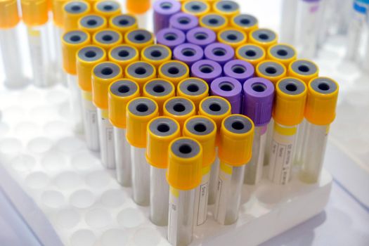 Selective focus a group of medical sample tube yellow and purple color , sample tube of blood for in the lab to diagnose the patient's disease