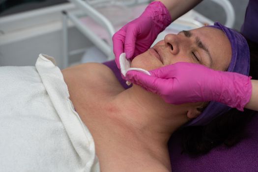 After cavitation peeling, the beautician cleans the face with cosmetic pads