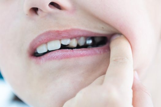 Portrait of little cute girl shows her orthodontic appliance on a white background.