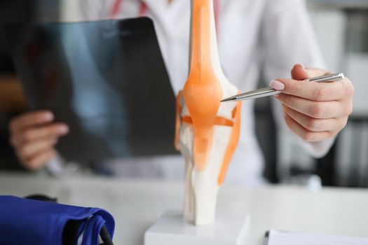 Doctor traumatologist examines x-ray and legs and the model of knee joint. Injuries and sprains concept