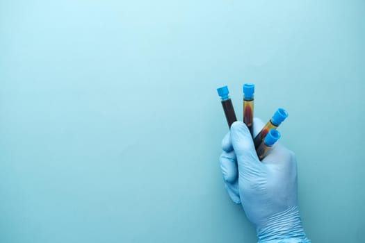 hand in blue medical gloves holding blood test tube ,
