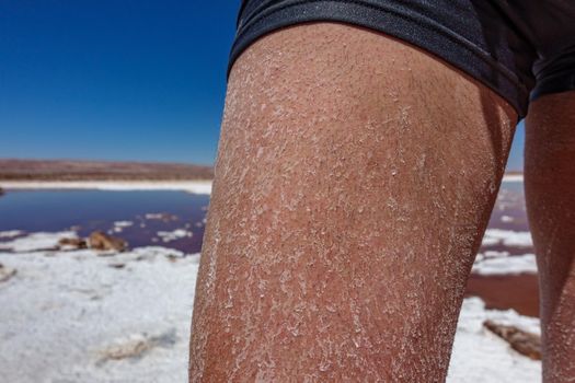 Closeup of man right leg with salt after swimming in Atacama salt lakes