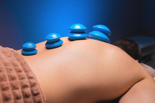 Cupping massage in general. Vacuum rubber cups for back massage for a man. Massage with vacuum cups. Cupping treatments for back pain relief. A white male lies face down with suction cups mounted on his back