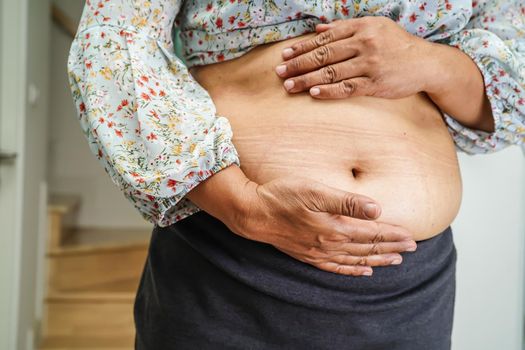 Asian woman show fat belly big size overweight and obesity at office.