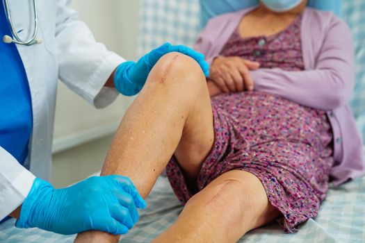 Asian elderly woman patient with scar knee replacement surgery in hospital.