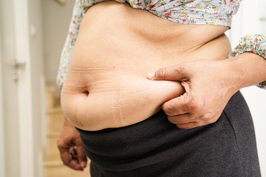 Overweight asian woman use hand to squeeze fat belly big size overweight and obesity.                