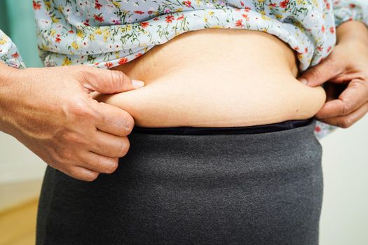 Overweight asian woman use hand to squeeze fat belly big size overweight and obesity.