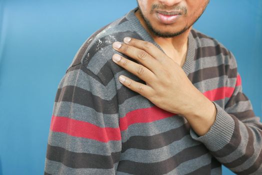 men with dandruff i on his coat .