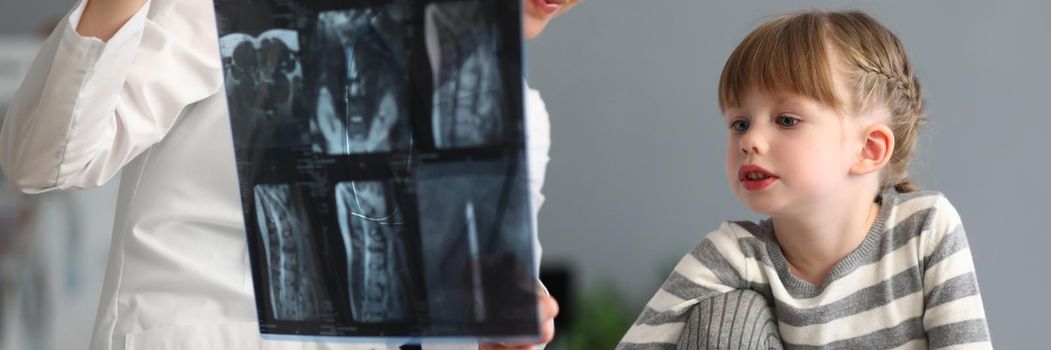 Woman doctor shows little girl an X-ray of spine. Curvature of spine and scoliosis in children