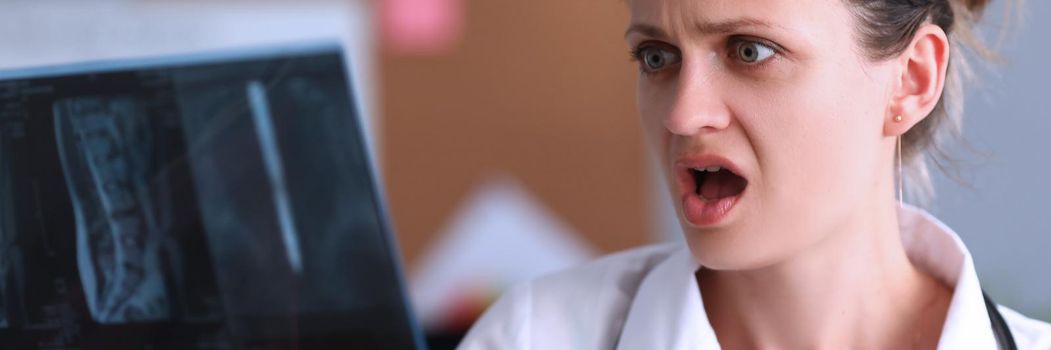 Shocked doctor looks at X-ray in clinic. X-ray changes in bone structure or tumor concept