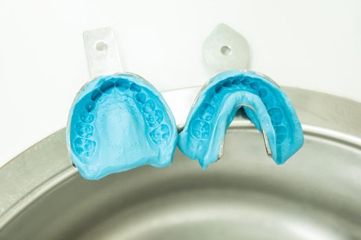 two blue alginate molds with two dental impression samples