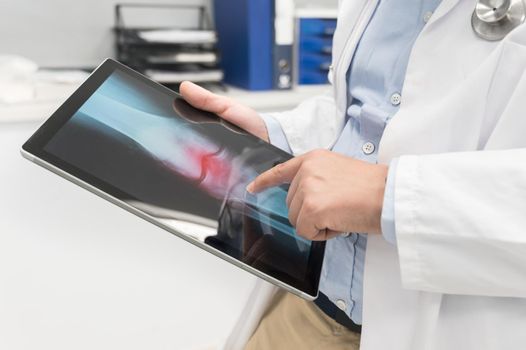 Unrecognizable Doctor is checking x-ray image at computer tablet, close up. Doctor at work in a hospital. Medicine and healthcare concept. High quality photography.
