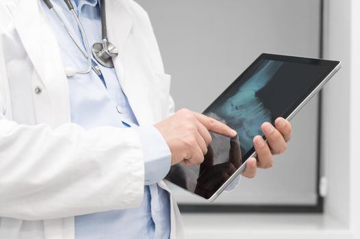 Unrecognizable Doctor is checking x-ray image at computer tablet, close up. Doctor at work in a hospital. Medicine and healthcare concept. High quality photography.