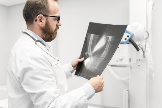 Doctor examine a film x-ray of a patient at radiology room. High quality photography.