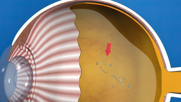 3D illustration medical animated eye anatomy, eye stain formation on blue background