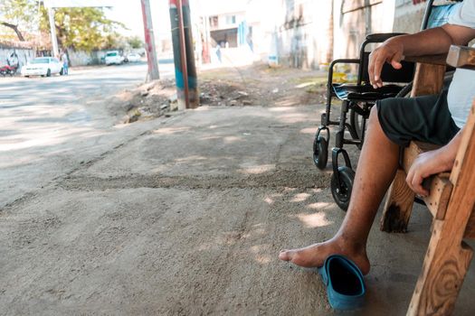 Closeup of a disabled Latino man, without a leg due to diabetes sitting outside his house in a chair with his wheelchair next to him.