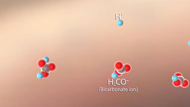 accumulation of carbon dioxide in the blood due to shortness of breath (respiratory acidosis)