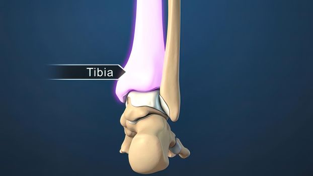 Foot and Ankle Fracture 3d medical illustration