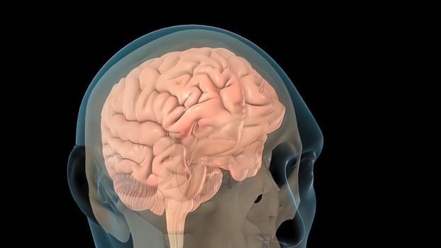 Mild traumatic brain injury may affect your brain cells temporarily. More-serious traumatic brain injury can result in bruising, torn tissues, bleeding and other physical damage to the brain. 3D illustration