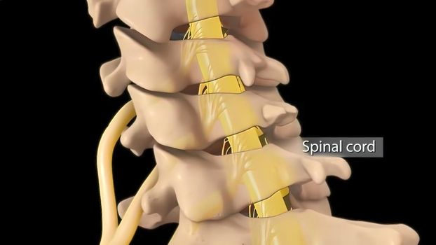 Anatomical view of the cervical spine with intervertebral disc-compressive nerve root prolapse. 3D illustration