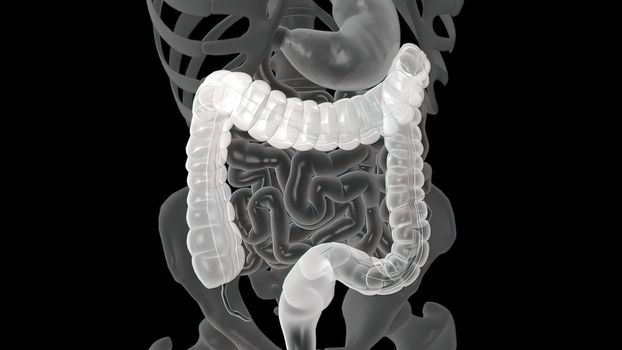 Colonoscopy Biopsy Of The Gastrointestinal Tract In Patients. 3D illustration