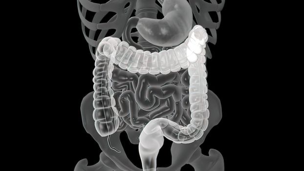 Colonoscopy Biopsy Of The Gastrointestinal Tract In Patients. 3D illustration