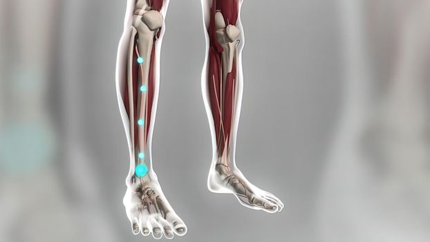 As a result of the vascular occlusion in the leg, signals are sent to the foot. Vascular occlusion removal process 3D illustration