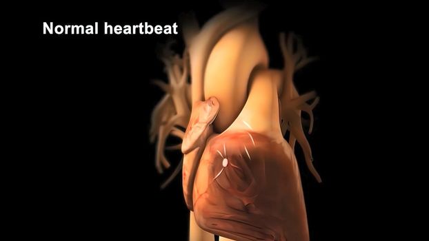The abnormal fast human heart increased heart rhythm rate at which it was in cardiac arrest, anxiety, or panic attacks, 3D Render