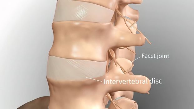 Chronic Low Back Pain. showing pain in the lower back 3D illustration