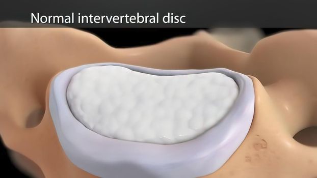 Top view of normal intervertebral disc 3D illustration