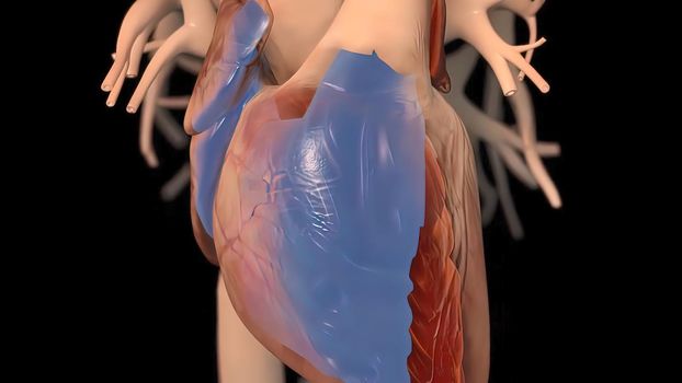 It means respiratory failure due to heart failure, edema, growth in the liver and obvious disease. 3D illustration