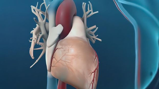 A coronary angioplasty is a procedure used to widen blocked or narrowed coronary arteries (the main blood vessels supplying the heart). 3D illustration