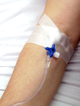 Close up of patient arm with perfusion tube in an hospital receiving medical treatment